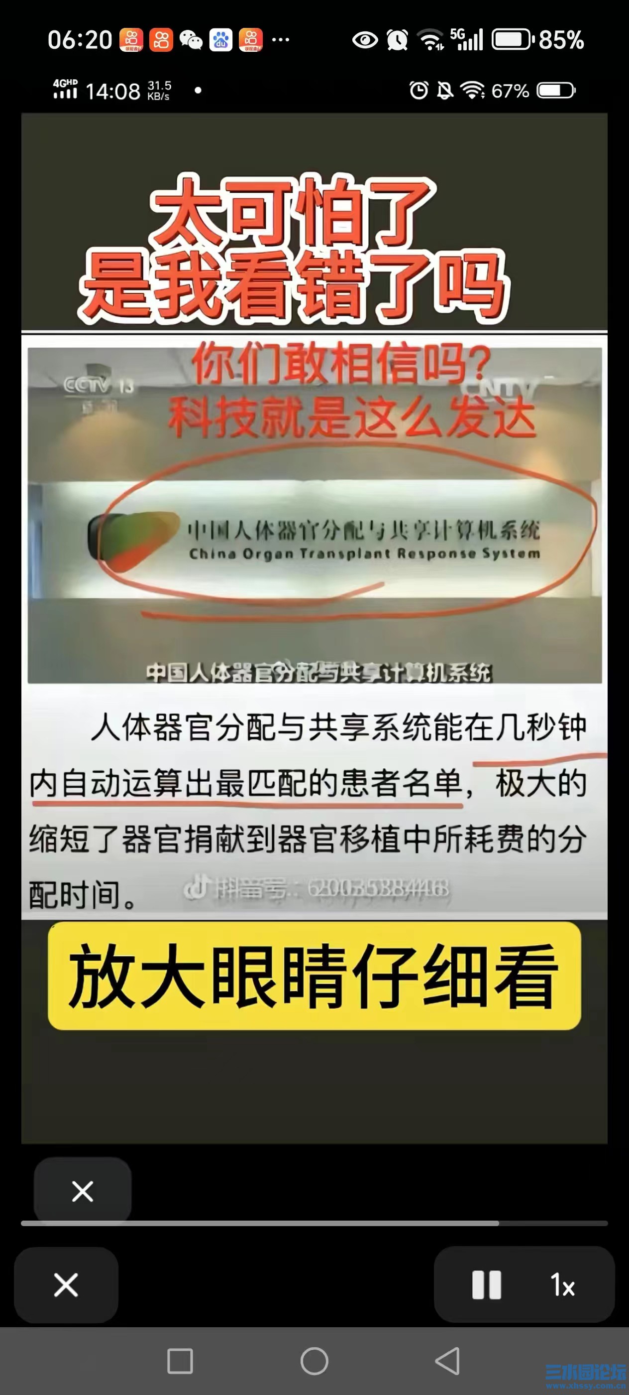 器官.jpg